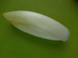 Salades d'endives aux noix : Photo de l'étape 3